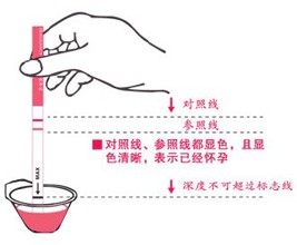 無(wú)痛人流術(shù)前檢查的項(xiàng)目