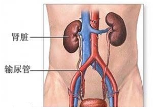 輸尿管結(jié)石治療