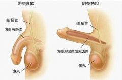 如何將陽痿扼殺在搖籃內(nèi)?