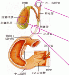 膽管結(jié)石的癥狀及早了解，及時(shí)發(fā)現(xiàn)病情