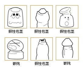 包皮過長如何判斷？