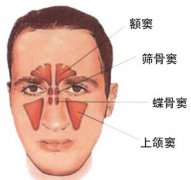 讓鼻竇炎遠(yuǎn)離您的七項(xiàng)措施