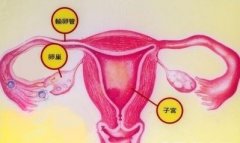 檢查輸卵管 造影更受不孕女性歡迎