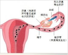專家支招：6招助你預(yù)防卵巢“提早下崗”