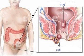 肛門疼痛怎么了